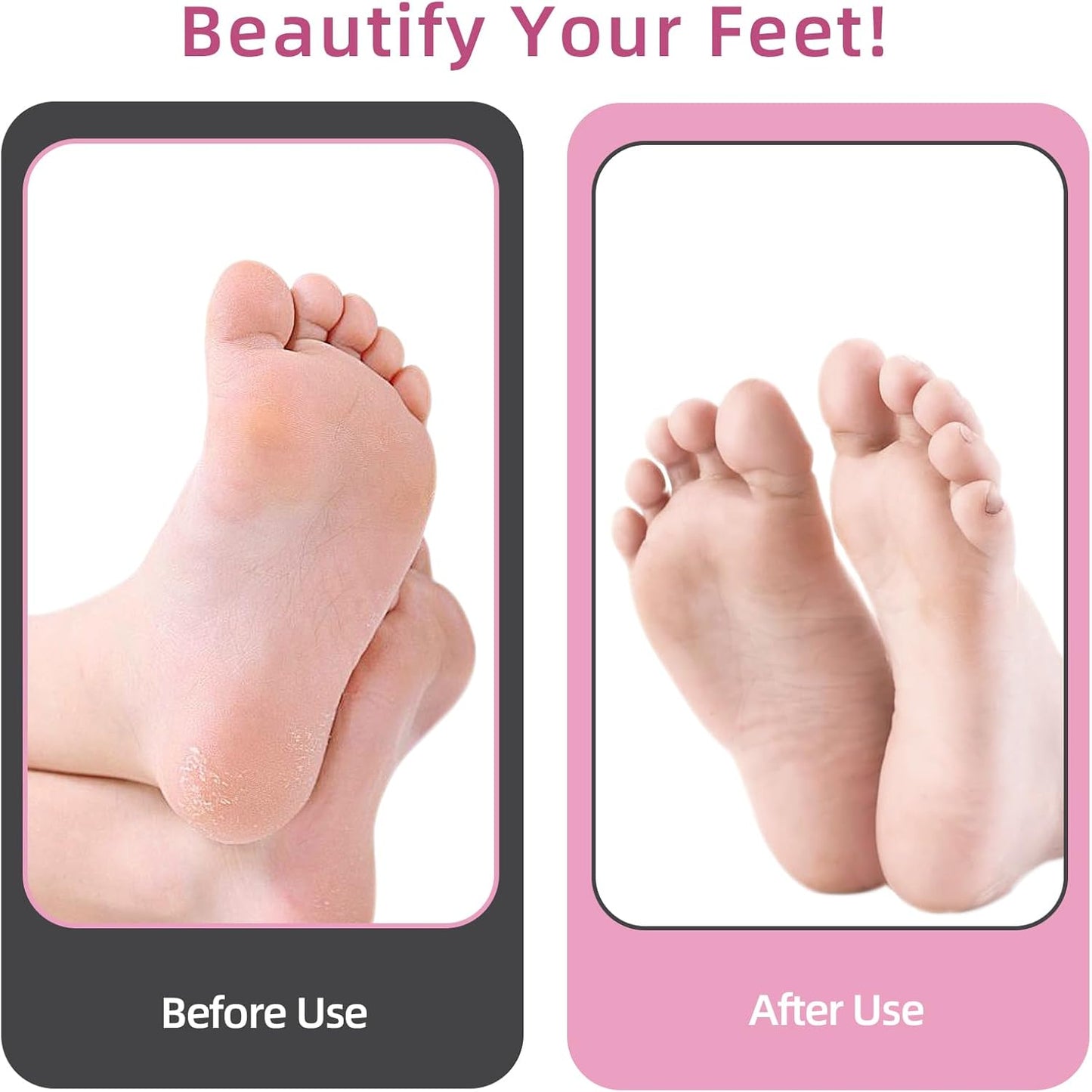 4.8IN Longer Electric Foot Callus Remover with 80Pcs Sandpaper Discs, Professional Aluminum Callus Remover for Feet, Stepless Speed Control Pedicure Tools for Dead Skin